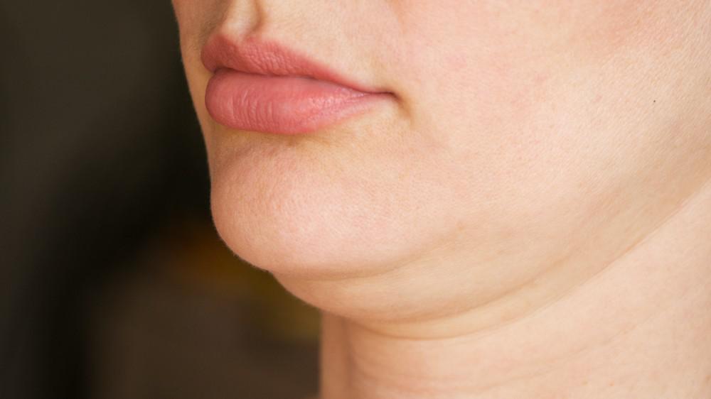 What causes a double chin in hindi