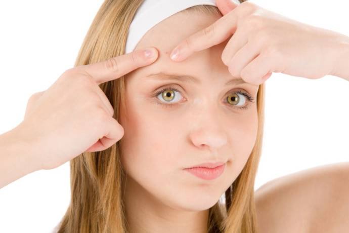 How to Get Rid of Forehead Pimples