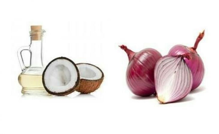  Onion Juice for Hair