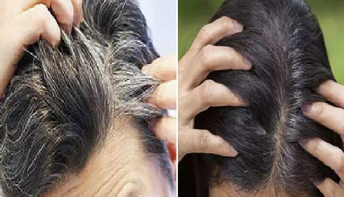 Gray Hair Solution in hindi