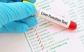 Liver Function Test (LFT)