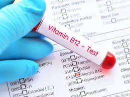 Vitamin D and B12 deficiency test 